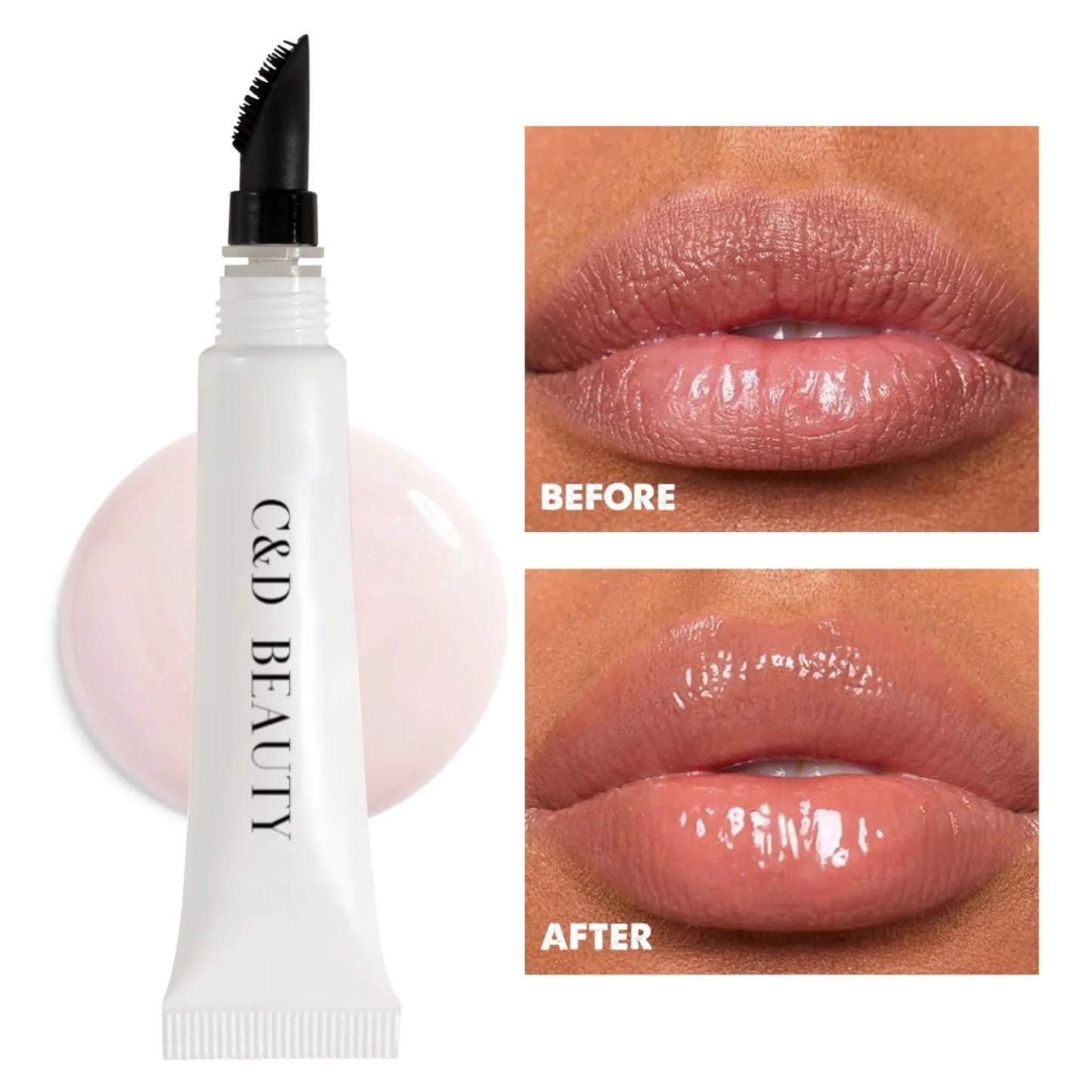 Lip Treatment